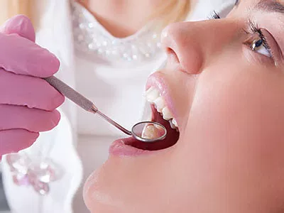 composite filling dentist Jupiter FL