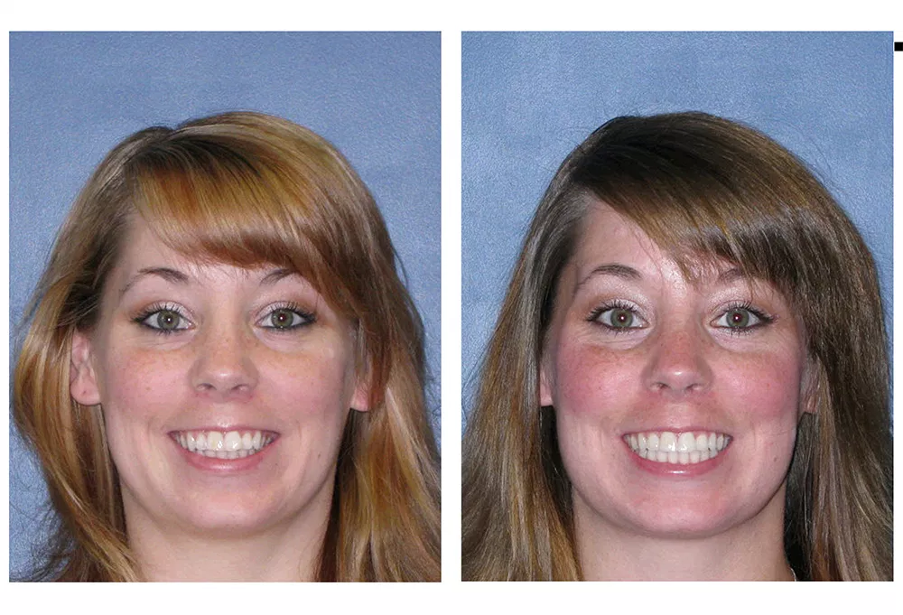 Attune Dentistry