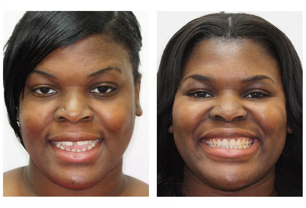 Attune Dentistry
