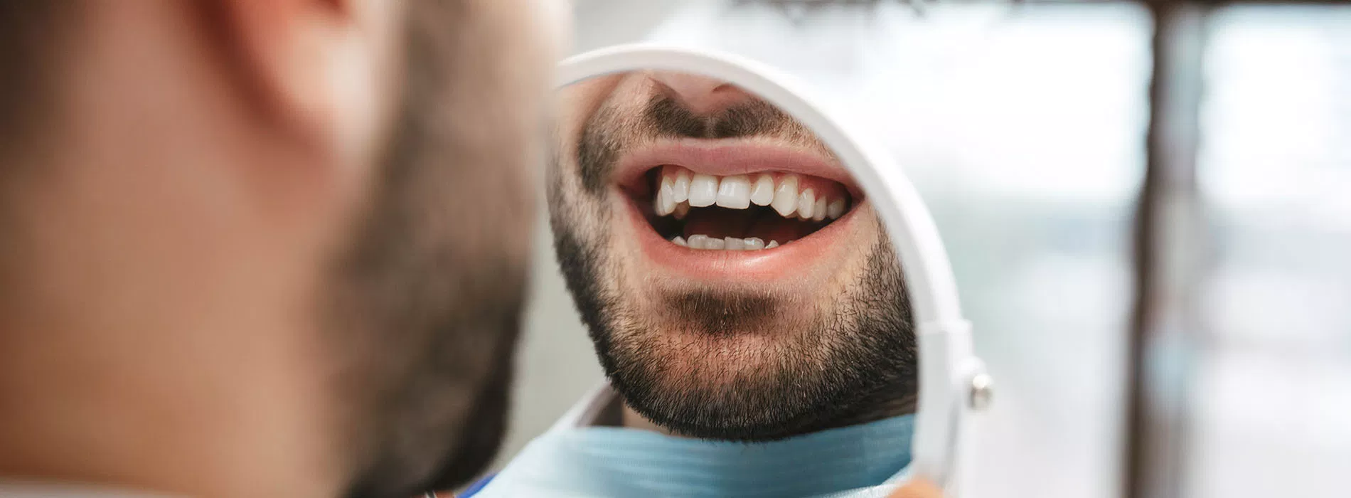 tooth inlay onlay restoration FL