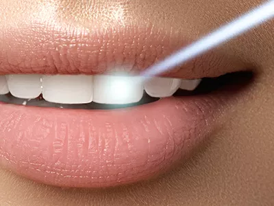 laser gum treatment near me