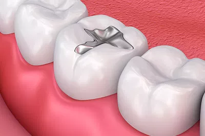 Attune Dentistry exterior office in Jupiter, FL
