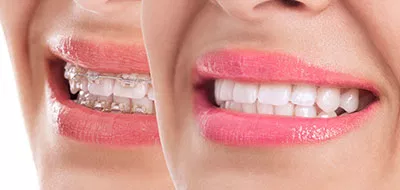Attune Dentistry exterior office in Jupiter, FL