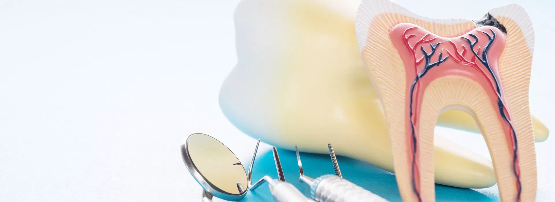 affordable root canal Jupiter FL