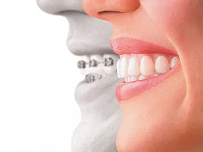 attune dentist