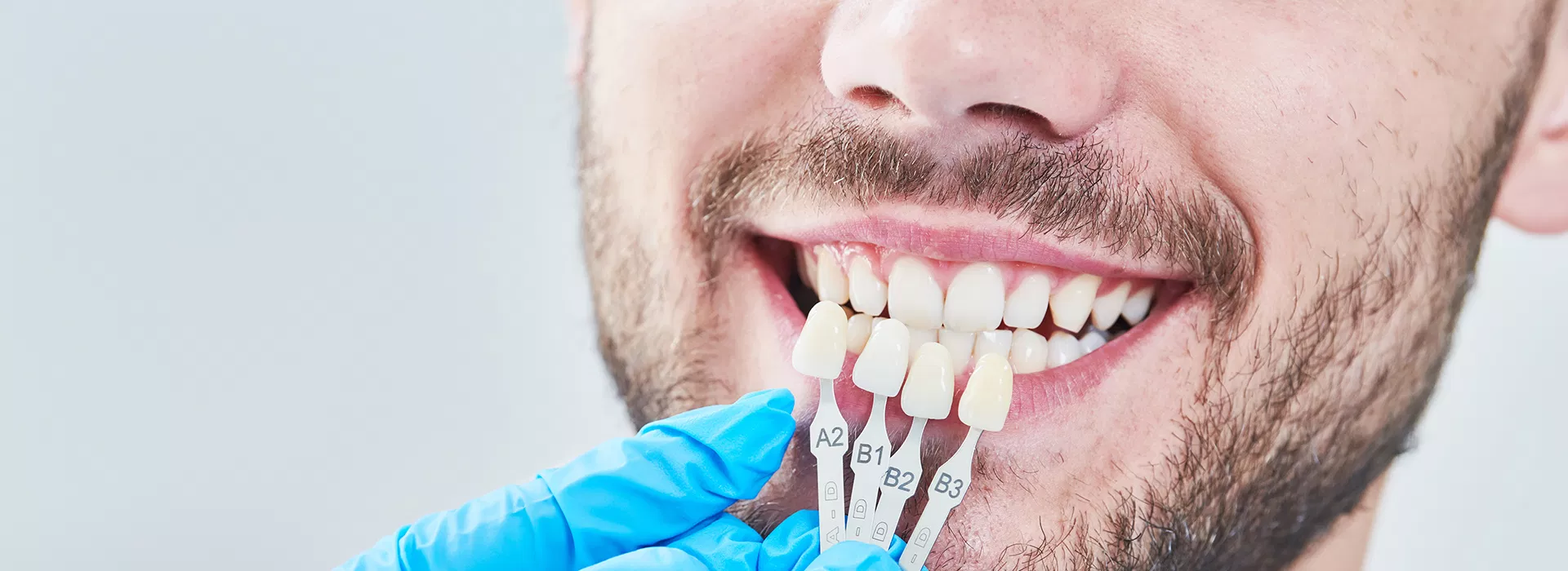 veneer dentist Palm Beach FL